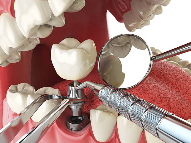 Best Emergency Orthodontic Repairs in Hudson Falls, NY